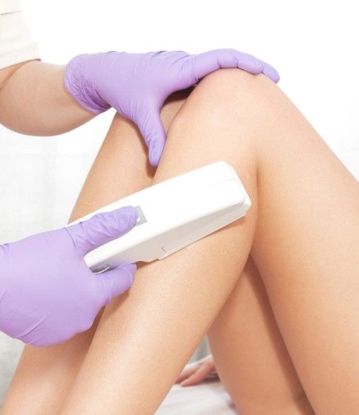 vectuslaserhairremoval